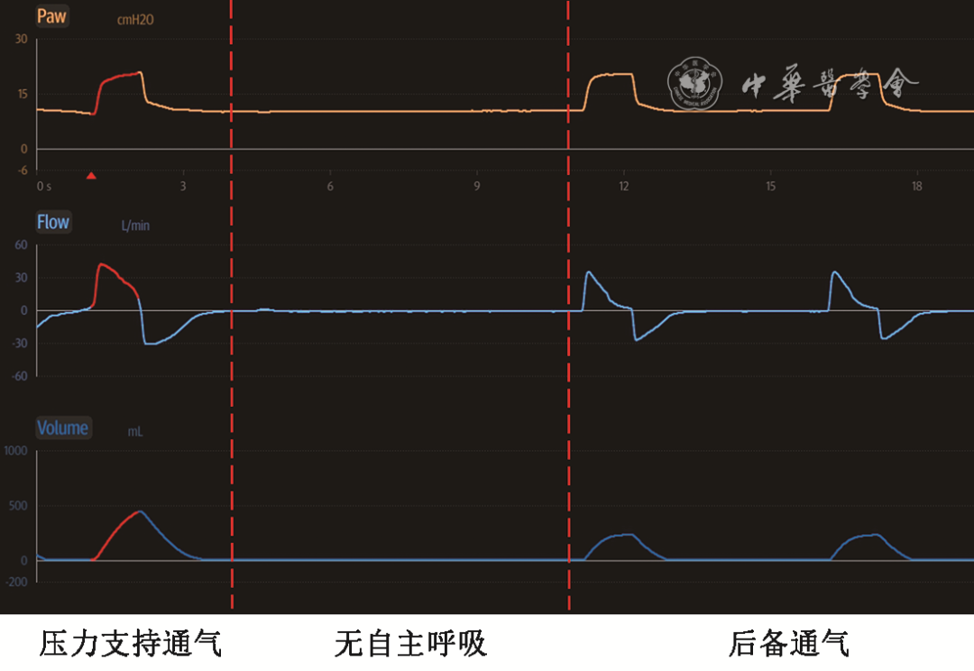 無創(chuàng)呼吸機