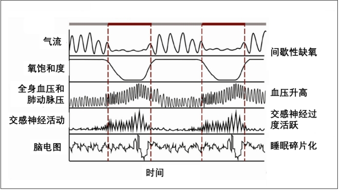 無(wú)創(chuàng)呼吸機(jī)